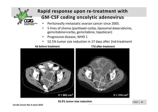 Rapid response upon re‐treatment with 
                           GM CSF coding oncolytic
                           GM‐CSF coding oncolytic adenovirus
                               •   Peritoneally metastatic ovarian cancer since 2005. 
                               •   5 lines of chemo (paclitaxel‐carbo, liposomal doxorubicine, 
                                   gemcitabine+carbo, gemcitabine, topotecan)
                               •   Progressive disease, WHO 1
                               •   52.5% tumor size reduction in 17 days after 2nd treatment
                                                                         y




                                                                              A k s e l i   H e m m i n k i       |     2 3  F e b  2 0 1 0    |    2 8
Cerullo Cancer Res in press 2010
 