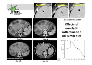 Baseline                 3 months              6 months




                                                        Senzer J Clin Oncol 2009

                                                       Effects of 
                                                       Effects of
                                                       oncolytic
                                                     inflammation 
                                                     inflammation
                                                     on tumor size




Reid Cancer Res 2002                                  A k s e l i   H e m m i n k i       |     2 3  F e b  2 0 1 0    |    3 5
 