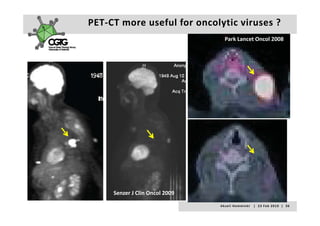 PET‐CT more useful for oncolytic viruses ?
                                    Park Lancet Oncol 2008




     Senzer J Clin Oncol 2009
                                A k s e l i   H e m m i n k i       |     2 3  F e b  2 0 1 0    |    3 6
 