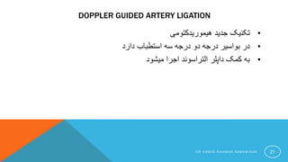 DOPPLER GUIDED ARTERY LIGATION
•‫هیموریدکتومی‬ ‫جدید‬ ‫تکنیک‬
•‫دارد‬ ‫استطباب‬ ‫سه‬ ‫درجه‬ ‫دو‬ ‫درجه‬ ‫بواسیر‬ ‫در‬
•‫میشود‬ ‫اجرا‬ ‫التراسوند‬ ‫داپلر‬ ‫کمک‬ ‫به‬
D R H A M I D R A H M A N S A B A W O O N 21
 