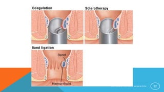 D R H A M I D R A H M A N S A B A W O O N 22
 