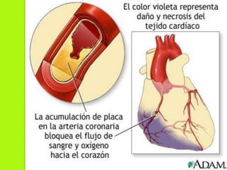 Patologías que requieren estudio de hemodinamia. 