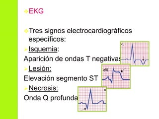EKG
Tres signos electrocardiográficos
específicos:
Isquemia:
Aparición de ondas T negativas
Lesión:
Elevación segmento ST
Necrosis:
Onda Q profunda
 