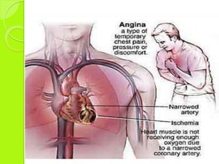 Patologías que requieren estudio de hemodinamia. 