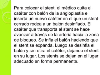 Para colocar el stent, el médico quita el
catéter con balón de la angioplastia e
inserta un nuevo catéter en el que un stent
cerrado rodea a un balón desinflado. El
catéter que transporta el stent se hace
avanzar a través de la arteria hacia la zona
de bloqueo. Se infla el balón haciendo que
el stent se expanda. Luego se desinfla el
balón y se retira el catéter, dejando el stent
en su lugar. Los stents se dejan en el lugar
adecuado en forma permanente.
 