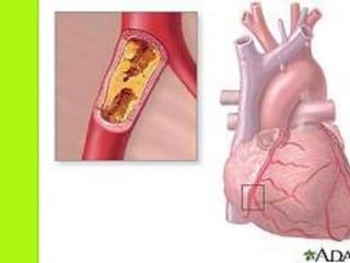Patologías que requieren estudio de hemodinamia. 