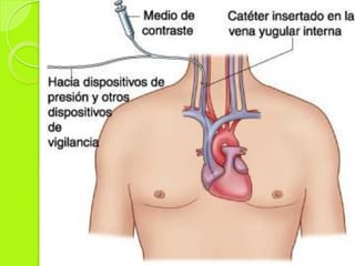 Patologías que requieren estudio de hemodinamia. 