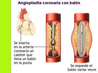 Patologías que requieren estudio de hemodinamia. 