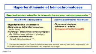 Hyperferritinémie et hémochromatoses
Claude EUGÈNE 16
Hyperferritinémies, saturation de la transferrine normale, mais surcharge en fer *
Maladie de la ferroportine Acéruloplasminémie héréditaire
- Hyperferritinémie très marquée
- Saturation de la transferrine nomale
(voire basse)
- Surcharge: prédominance macrophagique
(En IRM surcharge splénique > hépatique).
- Transmission dominante
(la seule hémochromatose **)
- Signes neurologiques
- Tendance à l'anémie
- Céruloplasminémie indosable
* Il y aussi des maladies avec hyperferritnémie et saturation normale, sans surcharge en fer: tableau plus loin.
** Hyperferritinémie à saturation normale chez les parents du 1er degré.
 