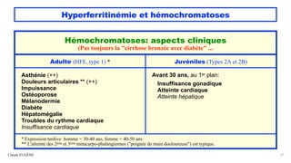 Hyperferritinémie et hémochromatoses
Claude EUGÈNE 21
Hémochromatoses: aspects cliniques
(Pas toujours la "cirrhose bronzée avec diabète" ...
Adulte (HFE, type 1) * Juvéniles (Types 2A et 2B)
Asthénie (++)
Douleurs articulaires ** (++)
Impuissance
Ostéoporose
Mélanodermie
Diabète
Hépatomégalie
Troubles du rythme cardiaque
Insuffisance cardiaque
Avant 30 ans, au 1er plan:
Insuffisance gonadique
Atteinte cardiaque
Atteinte hépatique
* Expression tardive: homme = 30-40 ans, femme = 40-50 ans
** L'atteinte des 2ème et 3ème métacarpo-phalangiennes ("poignée de main douloureuse") est typique.
 