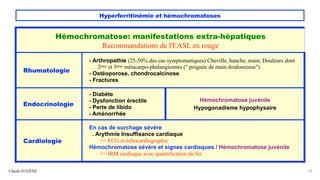 Hyperferritinémie et hémochromatoses
Claude EUGÈNE 22
Hémochromatose: manifestations extra-hépatiques
Recommandations de l'EASL en rouge
Rhumatologie
- Arthropathie (25-50% des cas symptomatiques) Cheville, hanche, main; Douleurs dont
2ème et 3ème métacarpo-phalangiennes (" poignée de main douloureuse").
- Ostéoporose, chondrocalcinose.
- Fractures
Endocrinologie
- Diabète
- Dysfonction érectile
- Perte de libido
- Aménorrhée
Hémochromatose juvénile
Hypogonadisme hypophysaire
Cardiologie
En cas de surchage sévère
. Arythmie Insuffisance cardiaque
=> ECG et échocardiographie
Hémochromatose sévère et signes cardiaques / Hémochromatose juvénile
=> IRM cardiaque avec quantification du fer
 