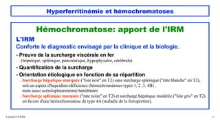Hyperferritinémie et hémochromatoses
Hémochromatose: apport de l'IRM
L'IRM
Conforte le diagnostic envisagé par la clinique et la biologie.
- Preuve de la surcharge viscérale en fer
(hépatique, splénique, pancréatique, hypophysaire, cérébrale)
- Quantification de la surcharge
- Orientation étiologique en fonction de sa répartition
. Surcharge hépatique marquée ("foie noir" en T2) sans surcharge splénique ("rate blanche" en T2),
soit un aspect d'hepcidino-déficience (hémochromatoses types 1, 2 ,3, 4B) ,
mais aussi acéruloplasminémie héréditaire.
. Surcharge splénique marquée ("rate noire" en T2) et surcharge hépatique modérée ("foie gris" en T2).
en faveur d'une hémochromatose de type 4A (maladie de la ferroportine).
Claude EUGÈNE 25
 