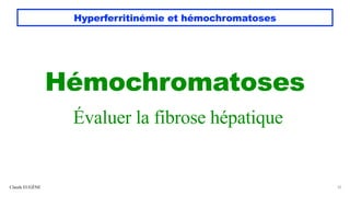 Hyperferritinémie et hémochromatoses
Hémochromatoses
Évaluer la fibrose hépatique
Claude EUGÈNE 32
 