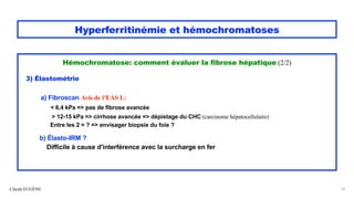 Hyperferritinémie et hémochromatoses
Hémochromatose: comment évaluer la fibrose hépatique (2/2)
3) Élastométrie
a) Fibrosc...