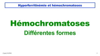 Hyperferritinémie et hémochromatoses
Hémochromatoses
Différentes formes
Claude EUGÈNE 38
 