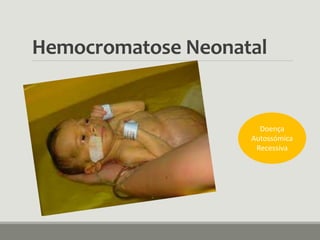 Hemocromatose Neonatal
Doença
Autossómica
Recessiva
 