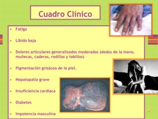 Cuadro Clínico
• Fatiga

• Libido baja

• Dolores articulares generalizados moderados (dedos de la mano,
  muñecas, caderas, rodillas y tobillos)

• Pigmentación grisácea de la piel.

• Hepatopatía grave

• Insuficiencia cardiaca

• Diabetes

• Impotencia masculina
 