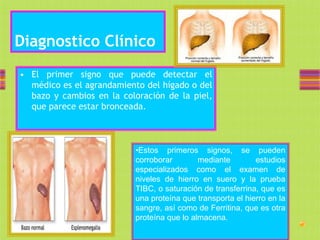 Diagnostico Clínico
• El primer signo que puede detectar el
  médico es el agrandamiento del hígado o del
  bazo y cambios en la coloración de la piel,
  que parece estar bronceada.



                           •Estos primeros signos, se pueden
                           corroborar        mediante        estudios
                           especializados como el examen de
                           niveles de hierro en suero y la prueba
                           TIBC, o saturación de transferrina, que es
                           una proteína que transporta el hierro en la
                           sangre, así como de Ferritina, que es otra
                           proteína que lo almacena.
 