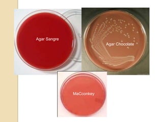 Agar Sangre
                          Agar Chocolate




              MaCconkey
 