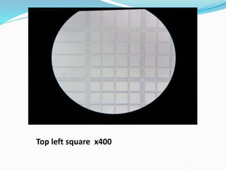 It is a technique used tienumerate the total cell count in the blood or ...