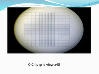 It is a technique used tienumerate the total cell count in the blood or ...