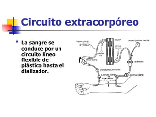 Circuito extracorpóreo

    La sangre se
    conduce por un
    circuito lineo
    flexible de
    plástico hasta el
    dializador.
 