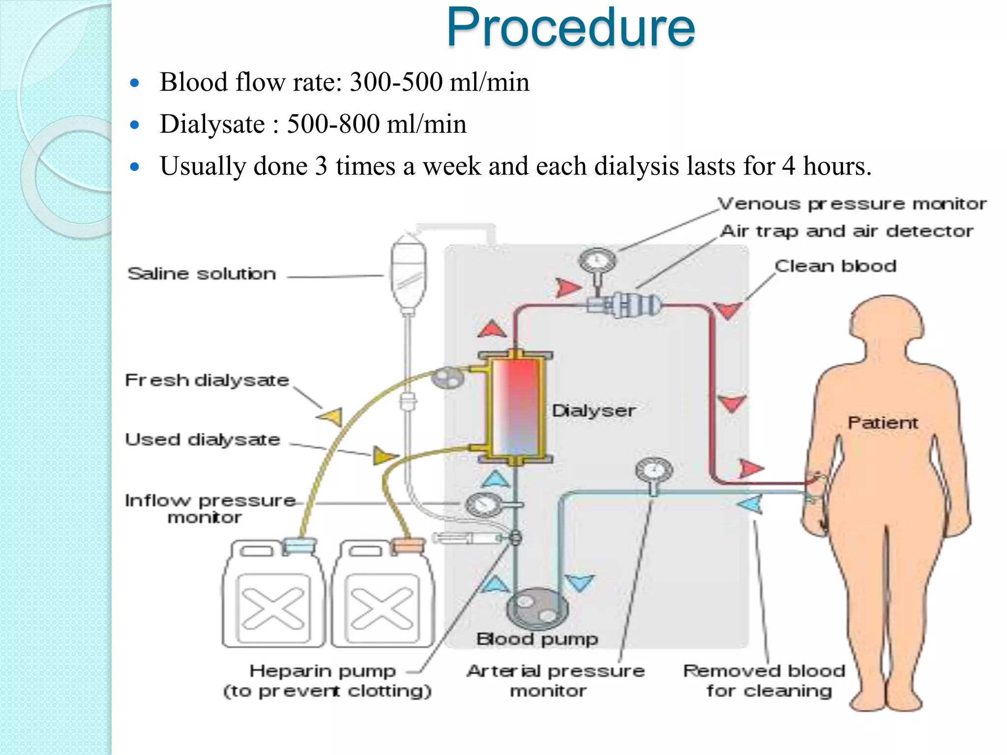 Hemodialysis | PPTX