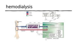 hemodialysis
 