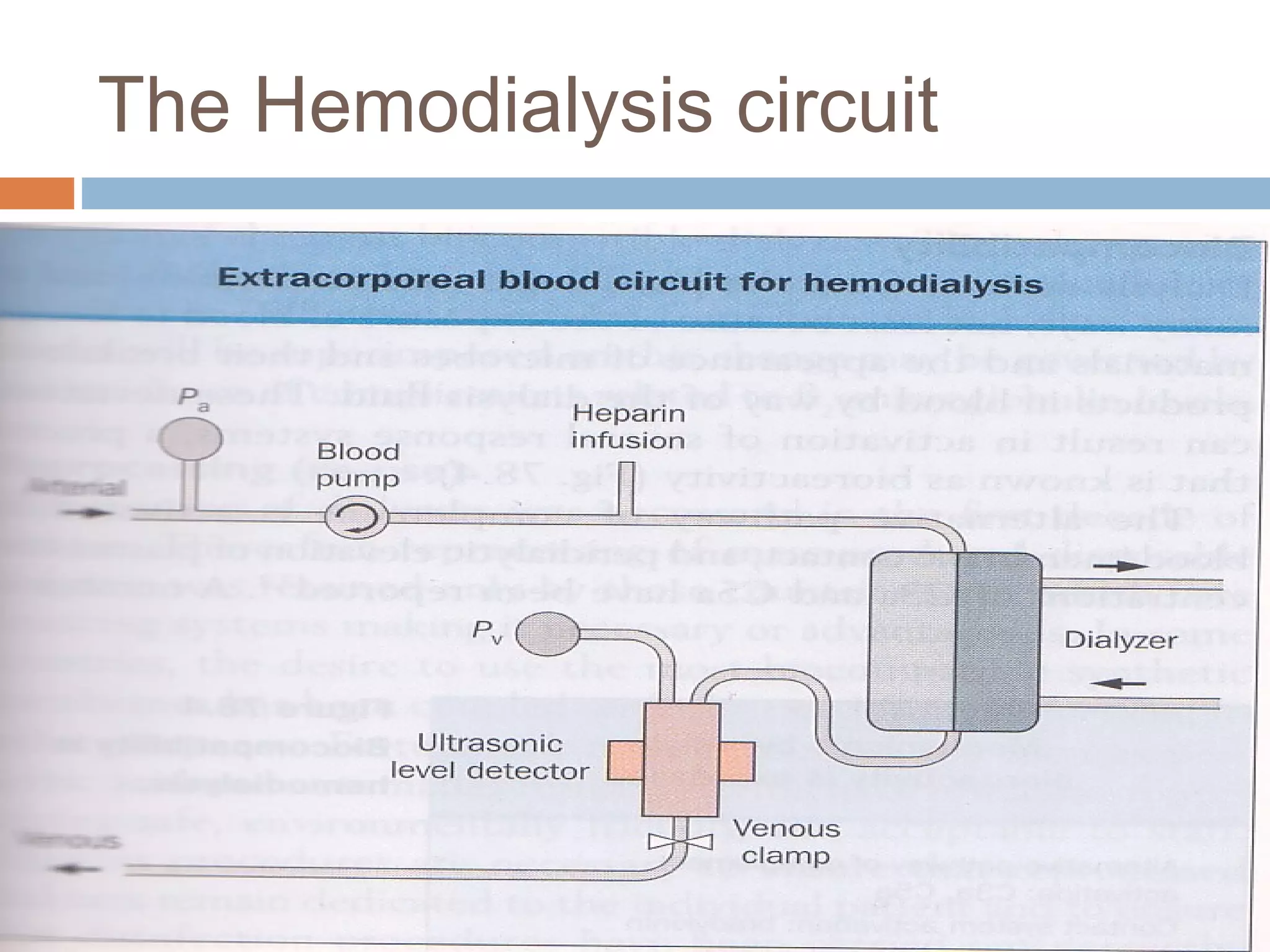 The Hemodialysis circuit
 