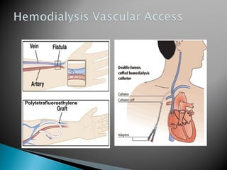 Polytetrafluoroethylene
 