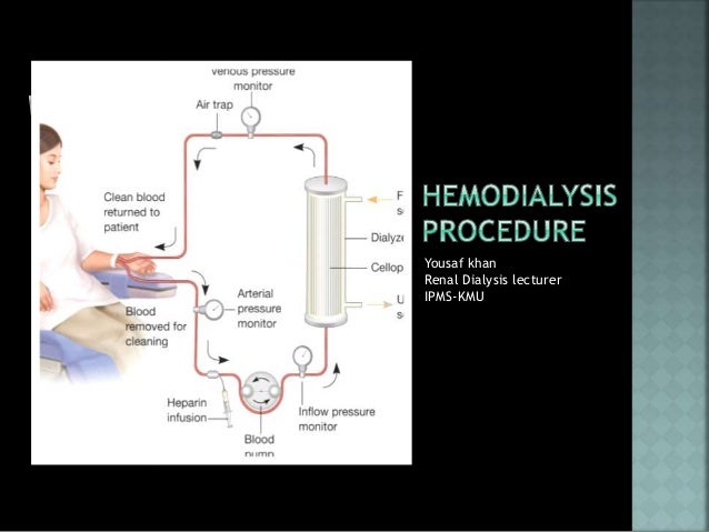 Diagram Of Hemodialysis