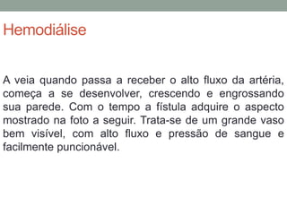 Hemodiálise
A veia quando passa a receber o alto fluxo da artéria,
começa a se desenvolver, crescendo e engrossando
sua parede. Com o tempo a fístula adquire o aspecto
mostrado na foto a seguir. Trata-se de um grande vaso
bem visível, com alto fluxo e pressão de sangue e
facilmente puncionável.
 