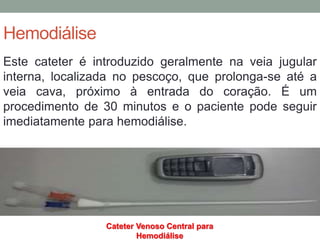 Hemodiálise
Este cateter é introduzido geralmente na veia jugular
interna, localizada no pescoço, que prolonga-se até a
veia cava, próximo à entrada do coração. É um
procedimento de 30 minutos e o paciente pode seguir
imediatamente para hemodiálise.
Cateter Venoso Central para
Hemodiálise
 