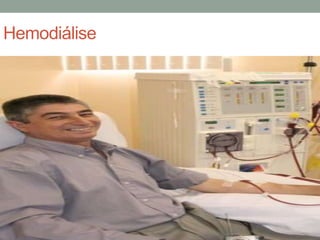 Hemodiálise
 