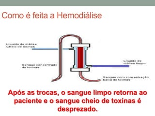 Como é feita a Hemodiálise
Após as trocas, o sangue limpo retorna ao
paciente e o sangue cheio de toxinas é
desprezado.
 
