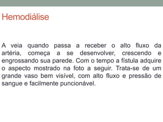 Hemodiálise
A veia quando passa a receber o alto fluxo da
artéria, começa a se desenvolver, crescendo e
engrossando sua parede. Com o tempo a fístula adquire
o aspecto mostrado na foto a seguir. Trata-se de um
grande vaso bem visível, com alto fluxo e pressão de
sangue e facilmente puncionável.
 