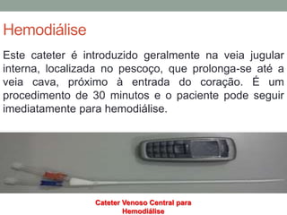 Hemodiálise
Este cateter é introduzido geralmente na veia jugular
interna, localizada no pescoço, que prolonga-se até a
veia cava, próximo à entrada do coração. É um
procedimento de 30 minutos e o paciente pode seguir
imediatamente para hemodiálise.
Cateter Venoso Central para
Hemodiálise
 
