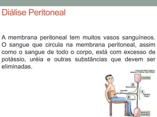 Diálise Peritoneal
A membrana peritoneal tem muitos vasos sanguíneos.
O sangue que circula na membrana peritoneal, assim
como o sangue de todo o corpo, está com excesso de
potássio, uréia e outras substâncias que devem ser
eliminadas.
 