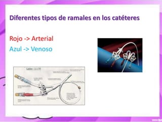 Diferentes tipos de ramales en los catéteres

Rojo -> Arterial
Azul -> Venoso
 