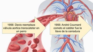 1956: Davis reemplaza
válvula aortica transcateter en
un perro
1956: André Cournard
cometo el catéter fue la
llave de la cerradura
 