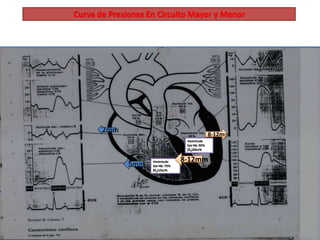 Curva de Presiones En Circuito Mayor y Menor 
Ventrículo 
Sat Hb: 75% 
[02)15cc% 
Ventrículo 
Sat Hb: 95% 
[02)20cc% 
8-12mm 
8-12mm 
5mm 
2mm 
 