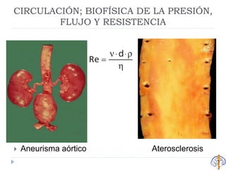 CIRCULACIÓN; BIOFÍSICA DE LA PRESIÓN,
FLUJO Y RESISTENCIA
 Aneurisma aórtico Aterosclerosis
 