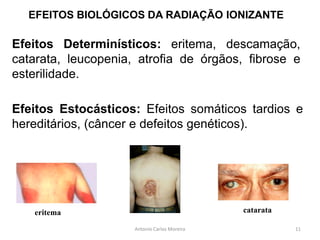 EFEITOS BIOLÓGICOS DA RADIAÇÃO IONIZANTE
Antonio Carlos Moreira
eritema catarata
Efeitos Determinísticos: eritema, descamação,
catarata, leucopenia, atrofia de órgãos, fibrose e
esterilidade.
Efeitos Estocásticos: Efeitos somáticos tardios e
hereditários, (câncer e defeitos genéticos).
11
 