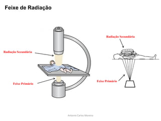 Radiação Secundária
Feixe Primário
Feixe de Radiação
Radiação Secundária
Feixe Primário
Antonio Carlos Moreira
 