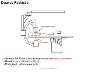 Dose de Radiação
Feixe Primário
Radiação Secundária
•Sistema Flat Panel (placa leitora sempre próxima ao paciente).
•Gerador (kV e mAs automático).
•Proteção do médico e paciente.
Antonio Carlos Moreira
 