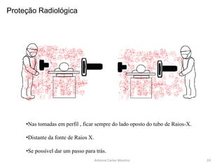 •Nas tomadas em perfil , ficar sempre do lado oposto do tubo de Raios-X.
•Distante da fonte de Raios X.
•Se possível dar um passo para trás.
Antonio Carlos Moreira
Proteção Radiológica
24
 