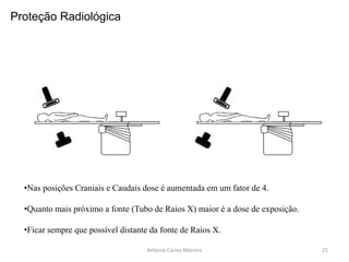 Antonio Carlos Moreira
•Nas posições Craniais e Caudais dose é aumentada em um fator de 4.
•Quanto mais próximo a fonte (Tubo de Raios X) maior é a dose de exposição.
•Ficar sempre que possível distante da fonte de Raios X.
Proteção Radiológica
25
 