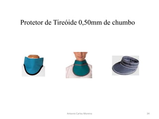 Antonio Carlos Moreira
Protetor de Tireóide 0,50mm de chumbo
34
 