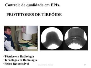 Controle de Qualidade
Antonio Carlos Moreira
Controle de qualidade em EPIs.
PROTETORES DE TIREÓIDE
•Técnico em Radiologia
•Tecnólogo em Radiologia
•Físico Responsável 37
 