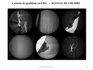 Antonio Carlos Moreira
Controle de qualidade em EPIs. - AVENTAL DE CHUMBO
39
 